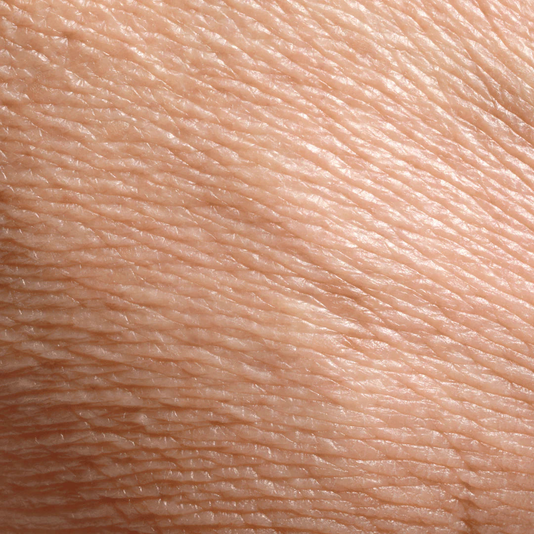Dull skin