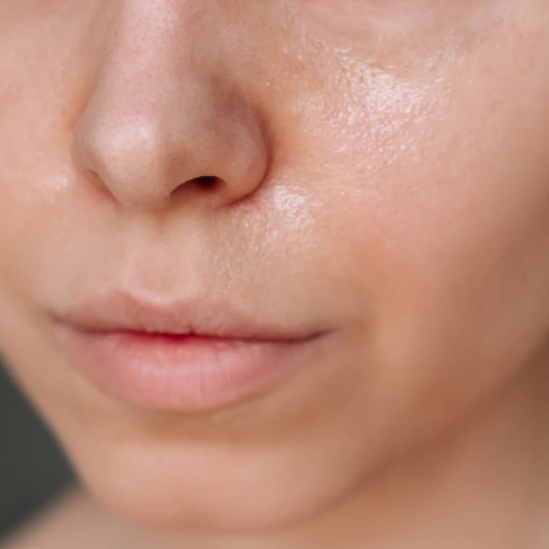 Oily skin
