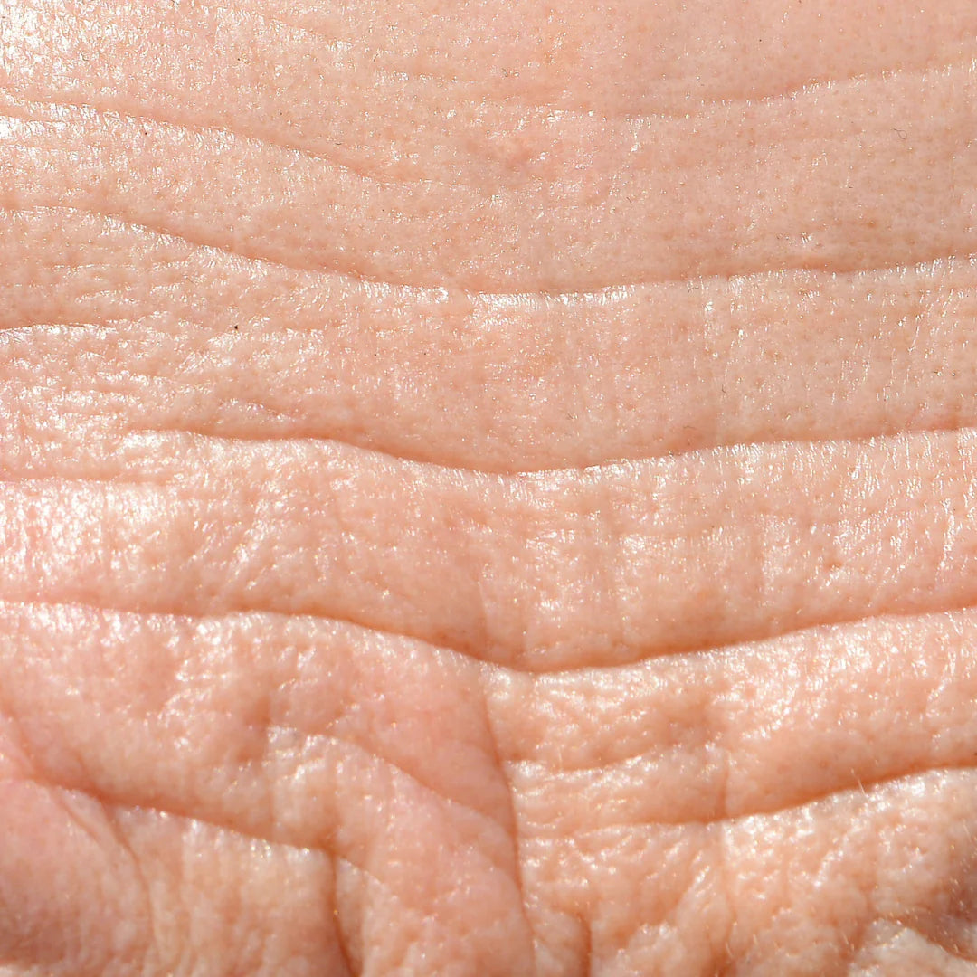 Anti-Aging