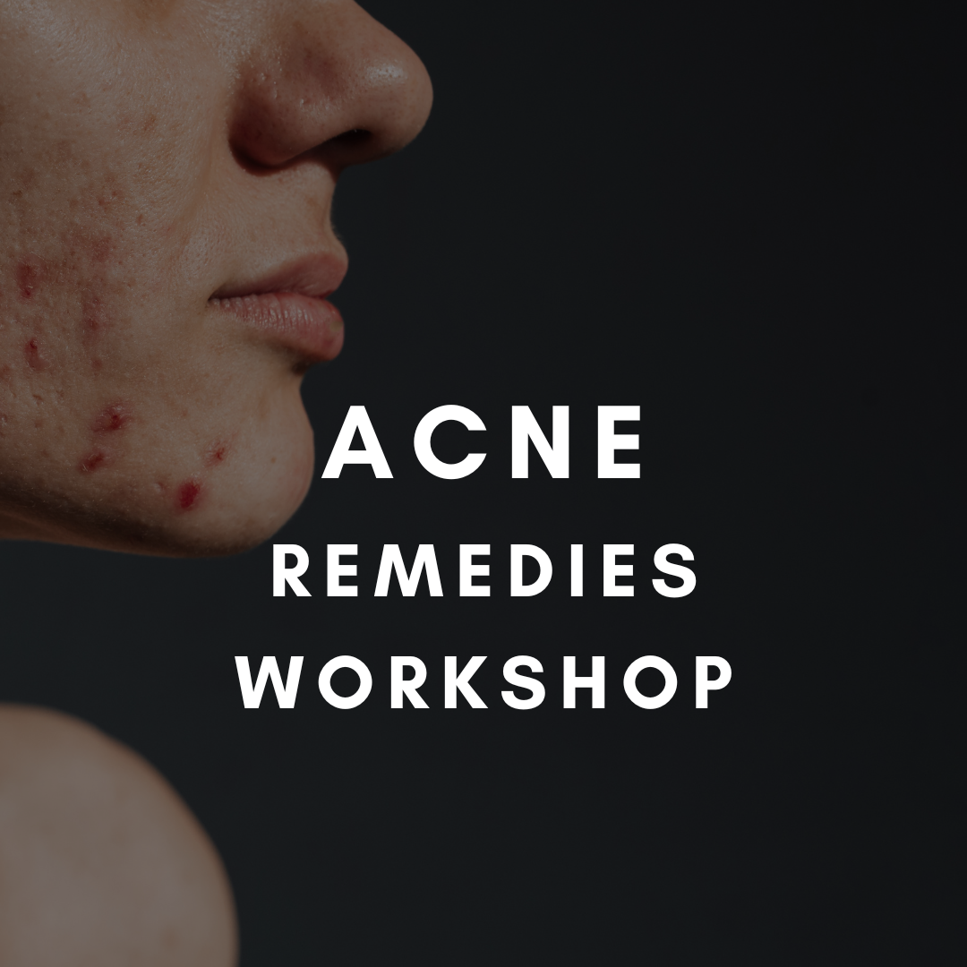 Acne remedies