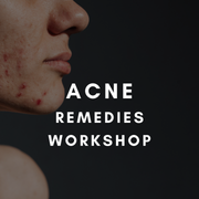 Acne remedies