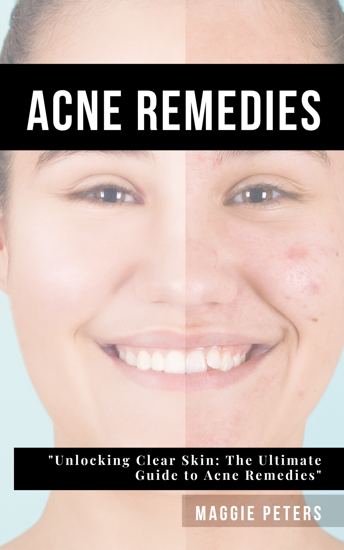 Acne remedies