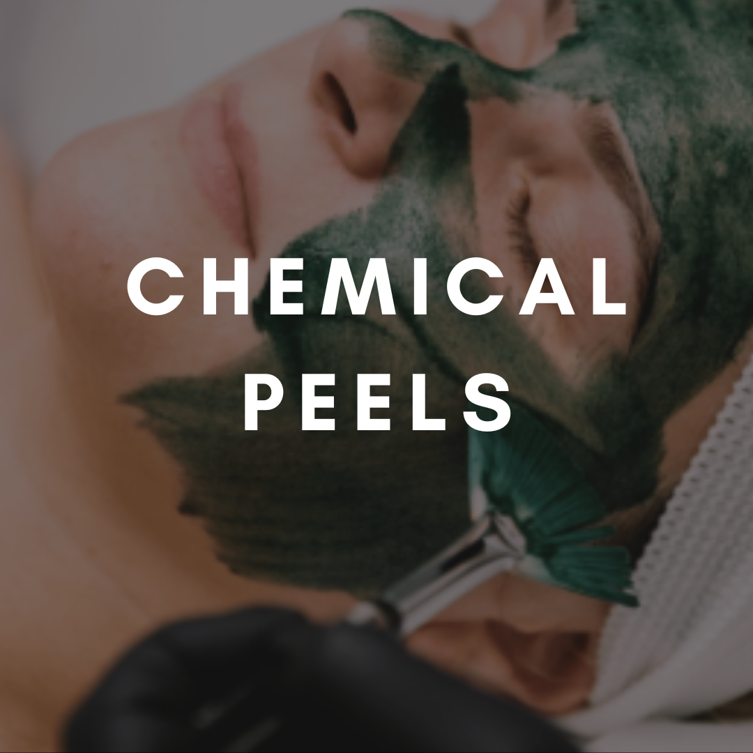 Chemical Peel course