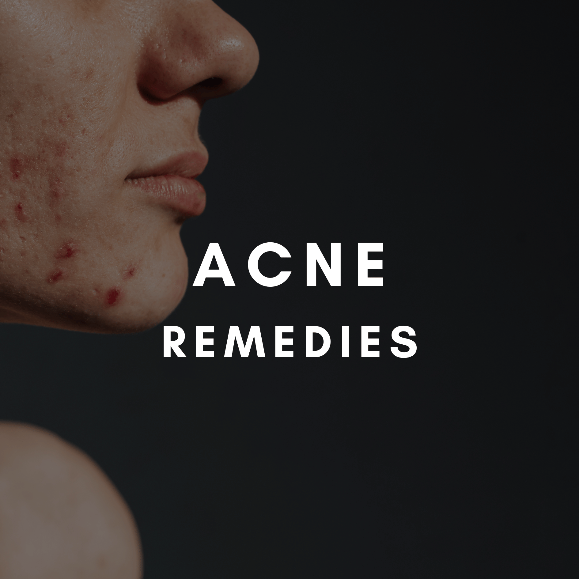 Advanced facial courses