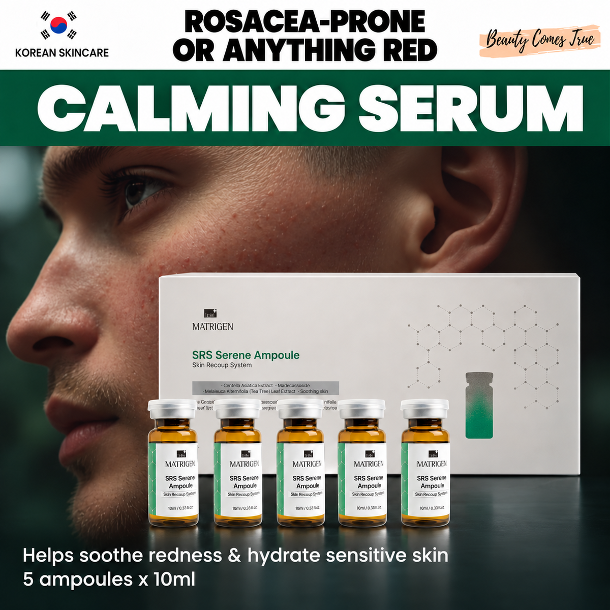 Matrigen SRS calming serum — Beauty Comes True
