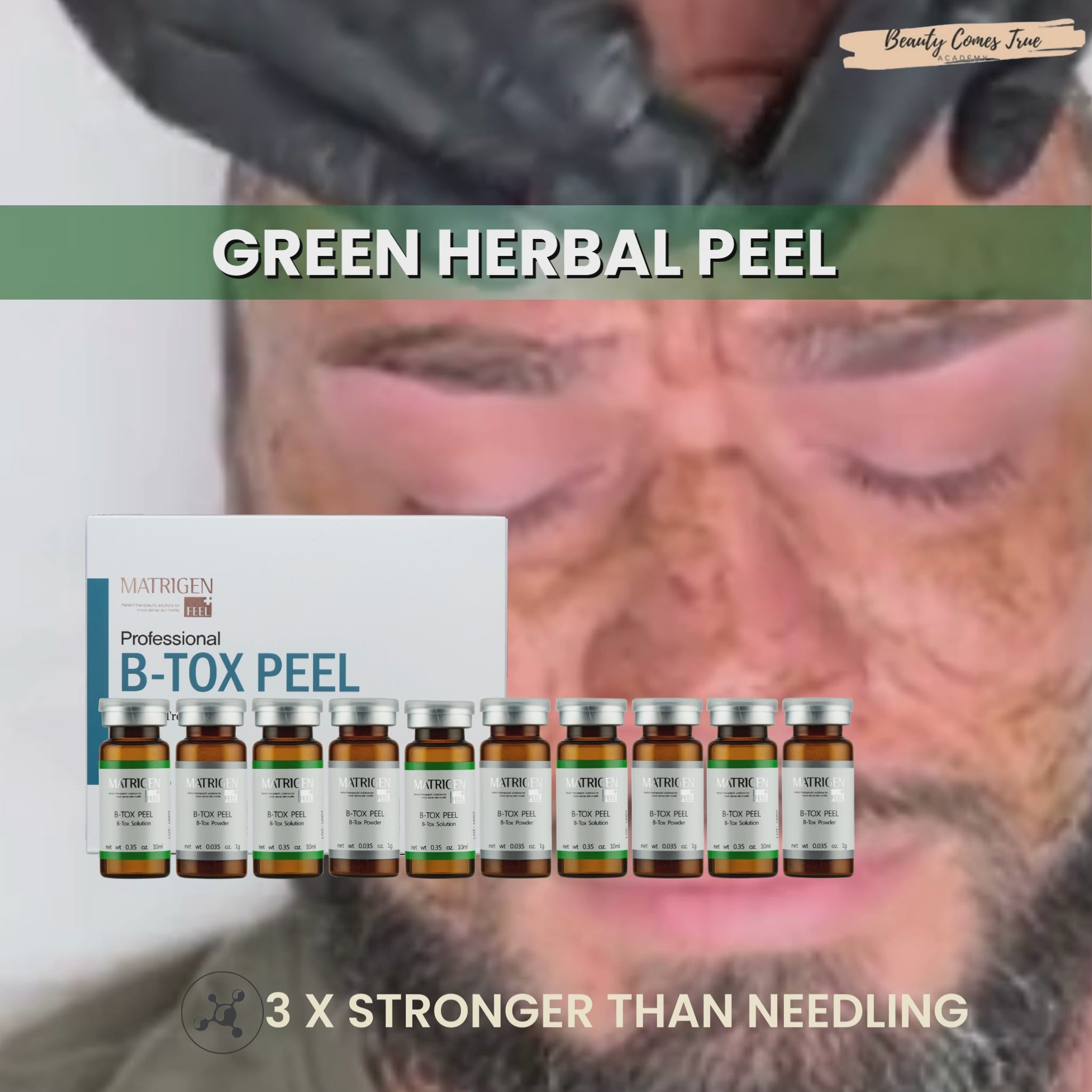 Load video: B-Tox peel Skin renewal program (green peel) Professional
