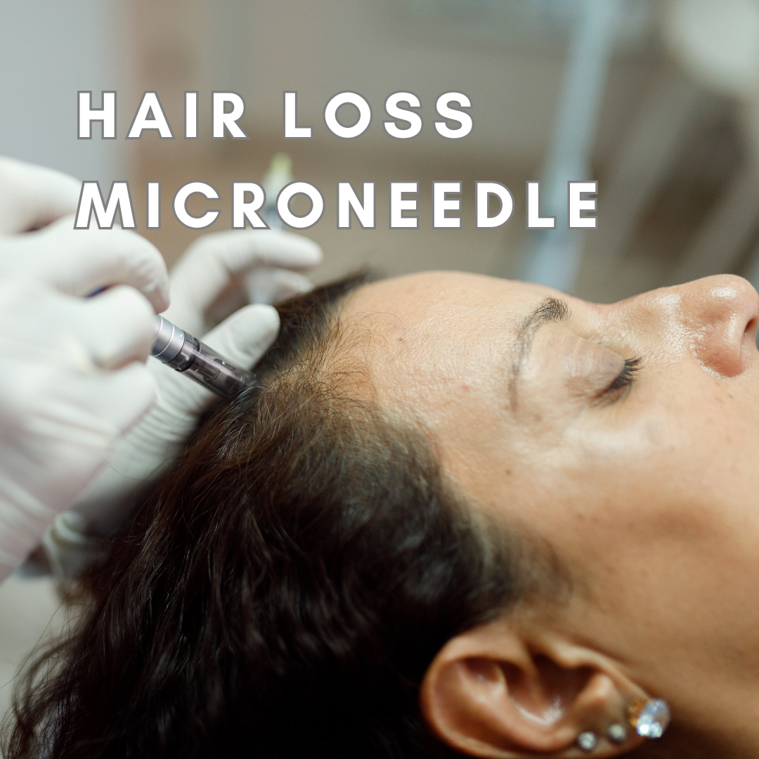 Microneedling hair loss course