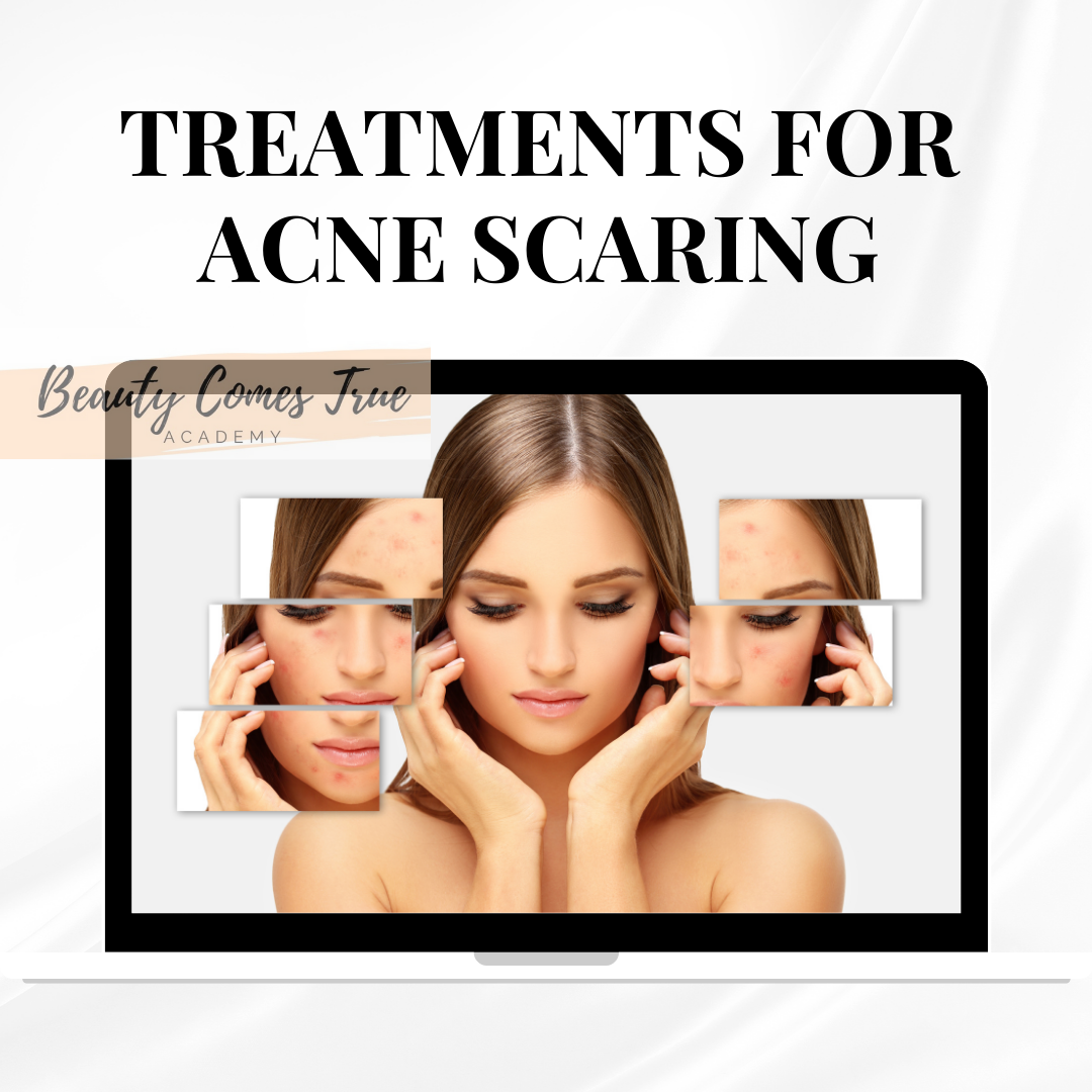 Treatments for acne scarring