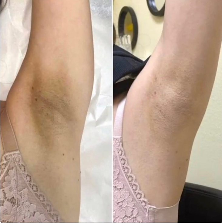 Intimate whitening course