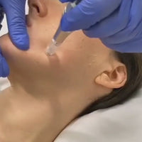 Microneedling course