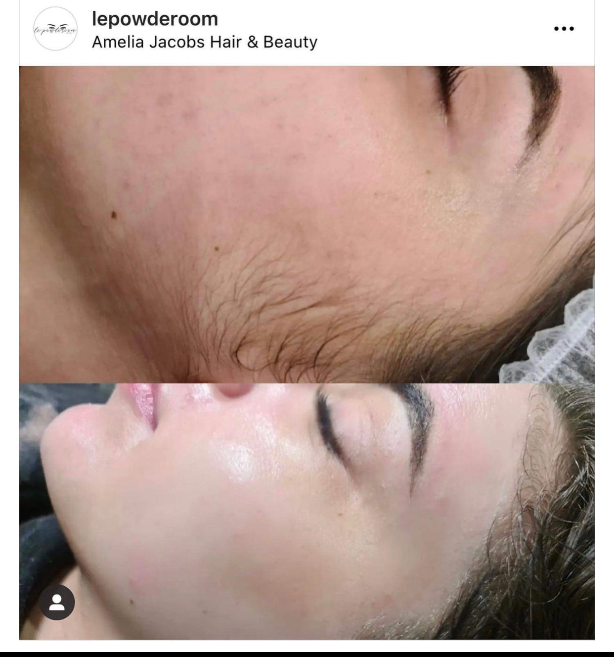 Dermaplanning course + kit